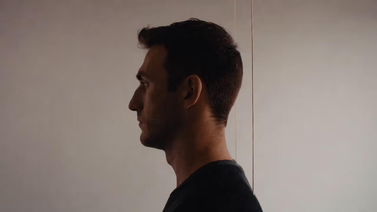 Side view showing forward head posture relative to shoulders